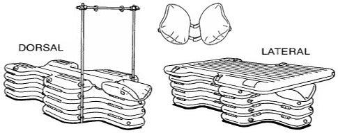 Diagram of the components of an inflatable independent equine srugery table